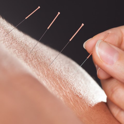 five-element acupuncture