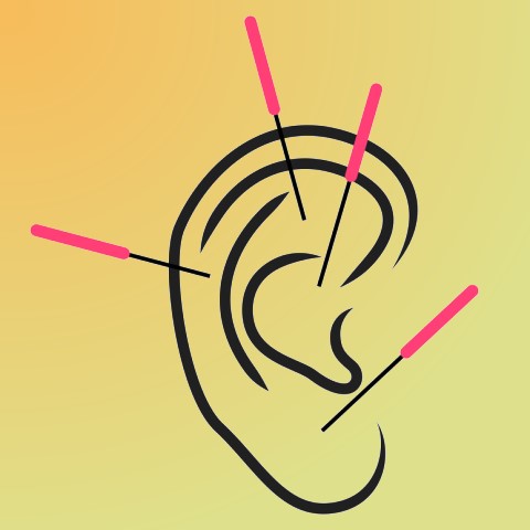 auricular acupuncture